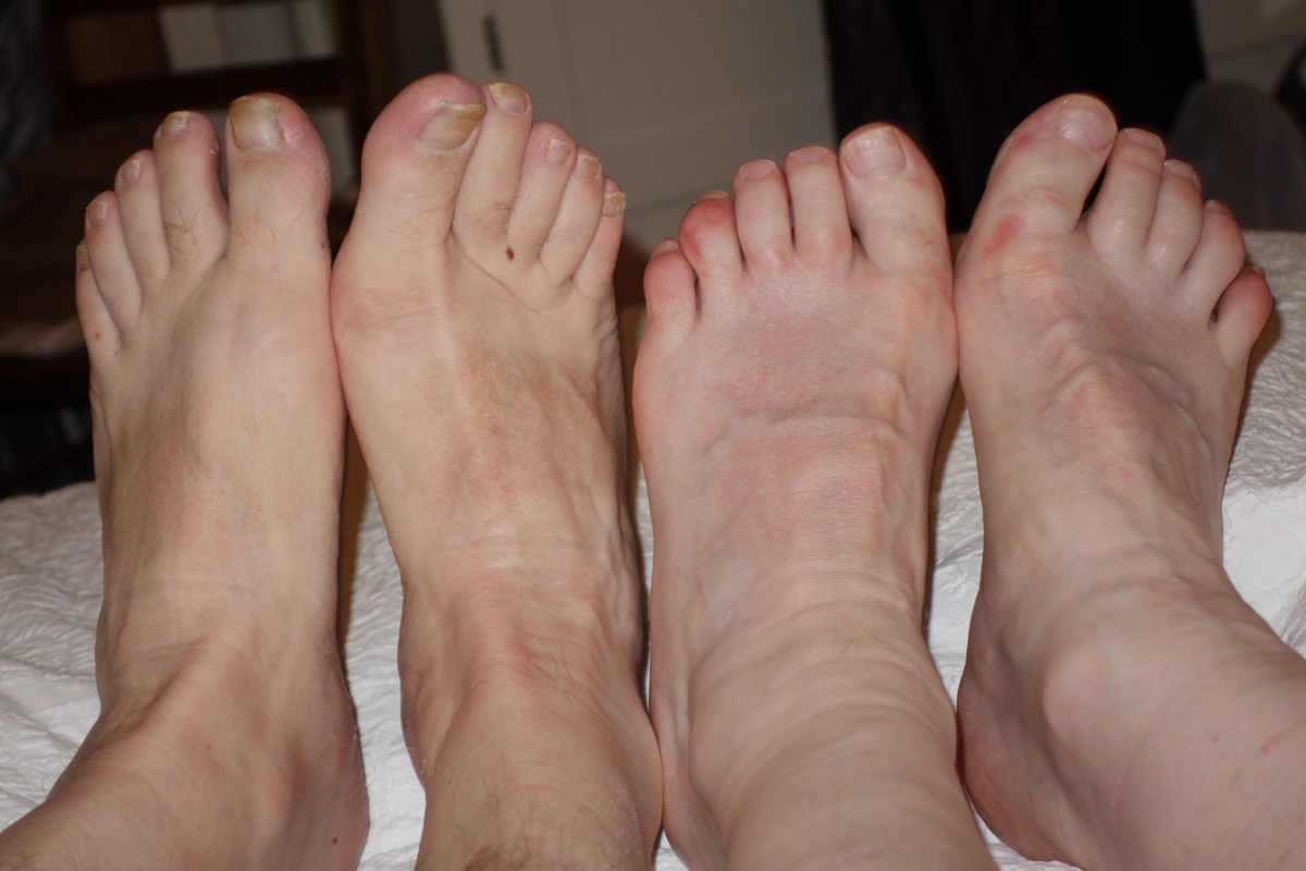 Day 8: Mitcheldean to&nbsp;Monmouth